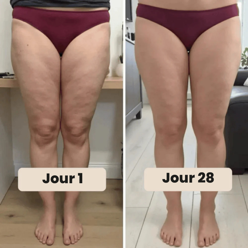 Avant / après : jour 1 et jour 28